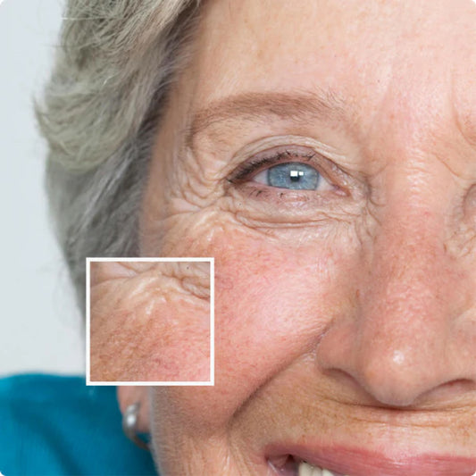 PLACENTA EXTRACT Eye Cream